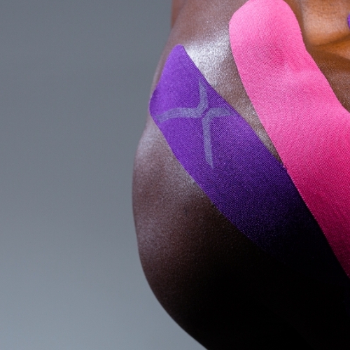 Kinesio-Taping-evidence-physical-therapy-clinton-laurel-glenn-dale-md