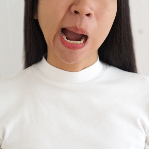 bells-palsy-evidence-physical-therapy-glenn-dale-clinton-laurel-md